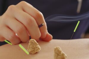 鍼灸が妊活に役立つ理由
